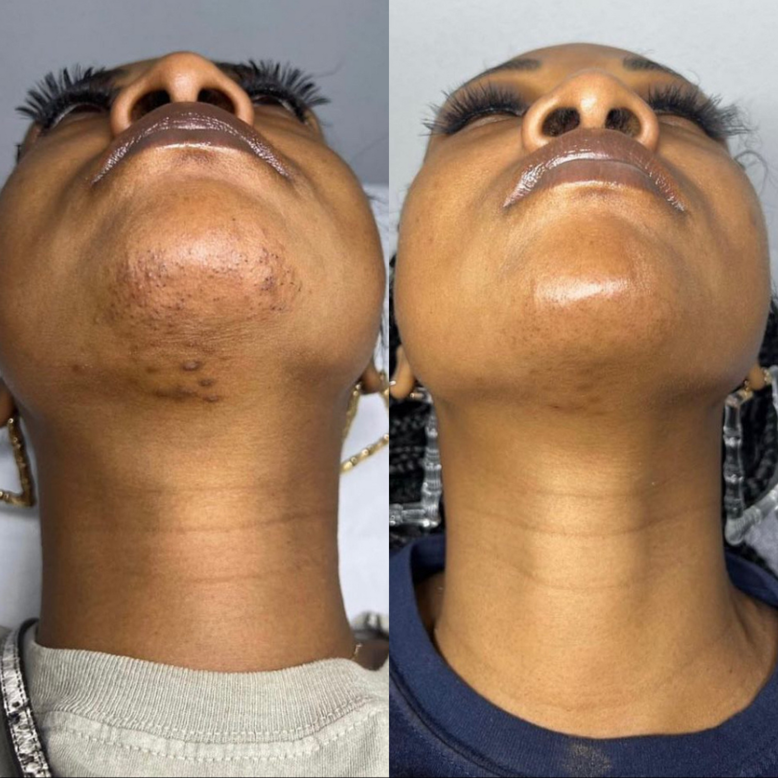 5.  No More Cuts, Razor Burn, or Irritation