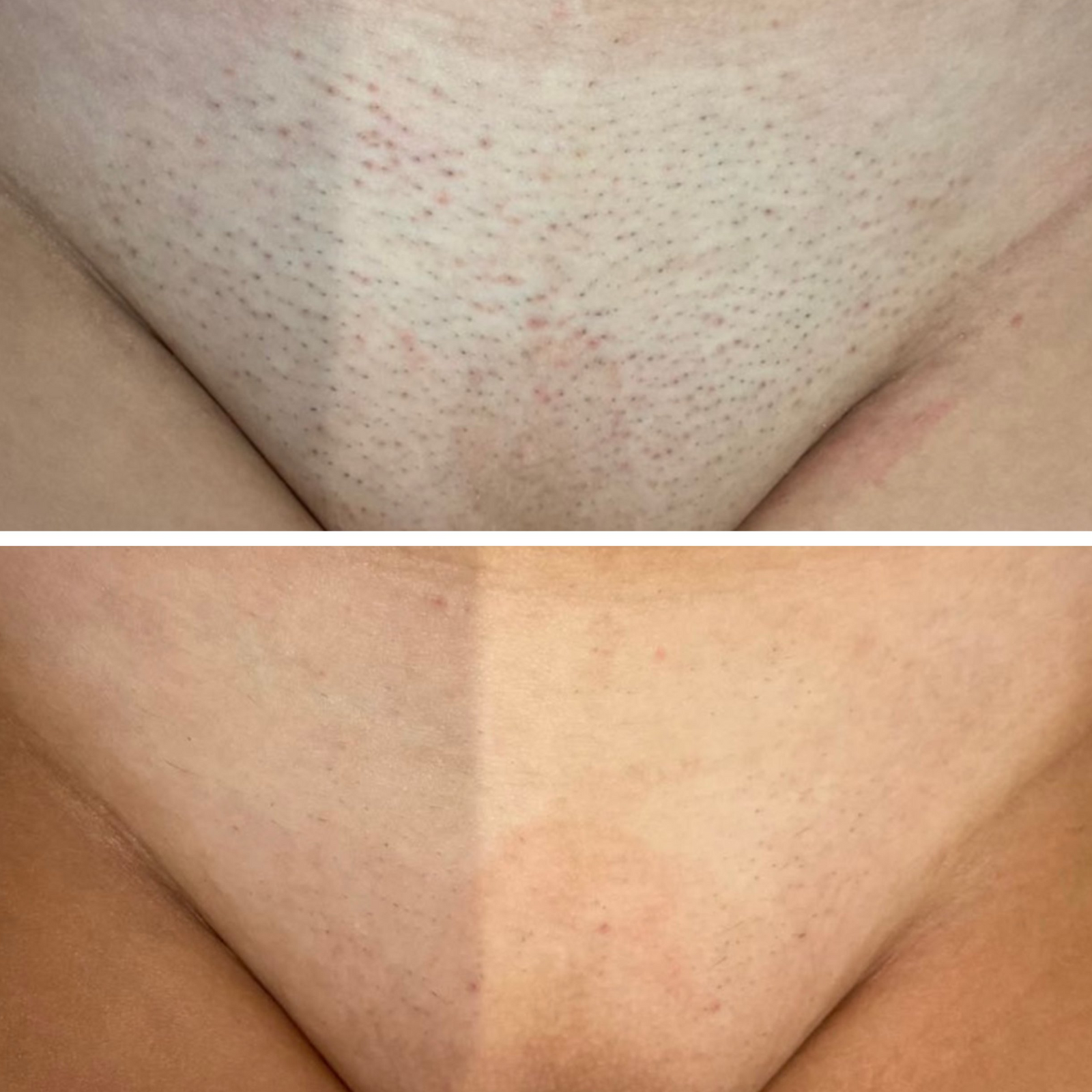 3. Safe For Every Part of Your Body