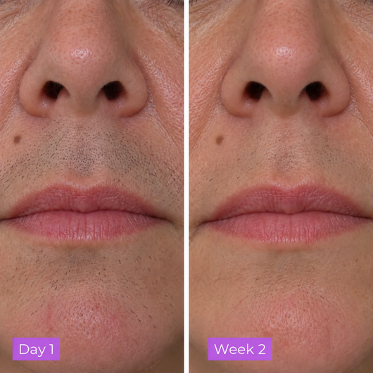 CyperGlow™ - Cyperus Rotundus Serum